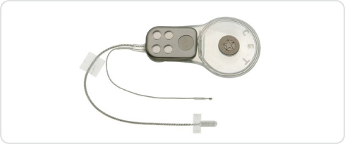 Image of an auditory brainstem  implant