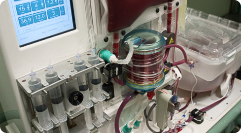 Liver on a perfusion machine