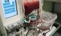 Liver on a perfusion machine